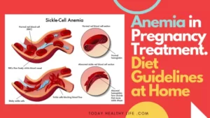 Severe Anemia in Pregnancy Treatment: Diet Guideline at Home