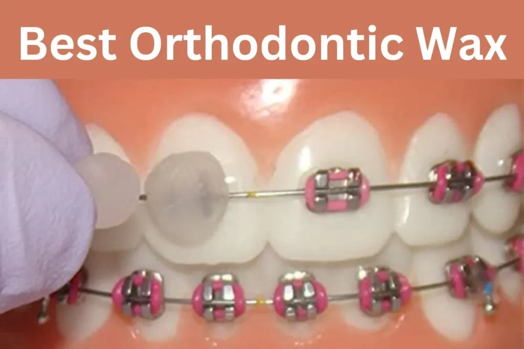 Best Orthodontic Wax for Braces